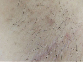 300人の腋 2　サンプル画像08